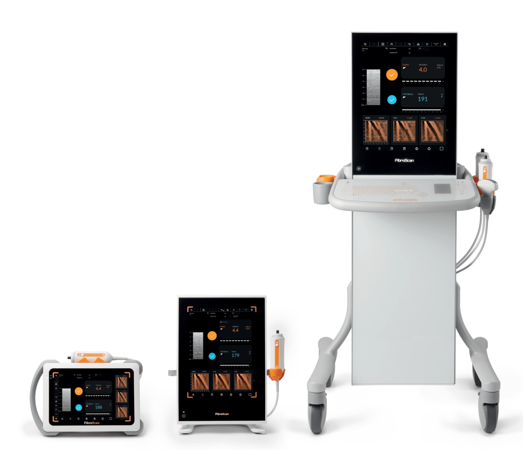 FibroScan transient elastography system used for non-invasive liver stiffness and steatosis measurement